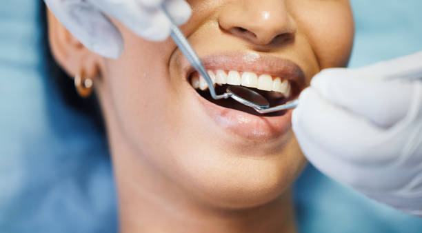 Best Emergency Wisdom Teeth Removal in Kinston, NC