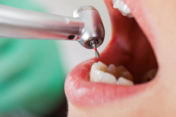 Best Weekend Emergency Dentist in Kinston, NC